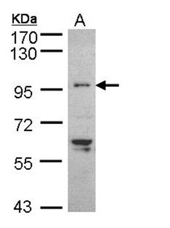 Anti-TNNI3K Antibody