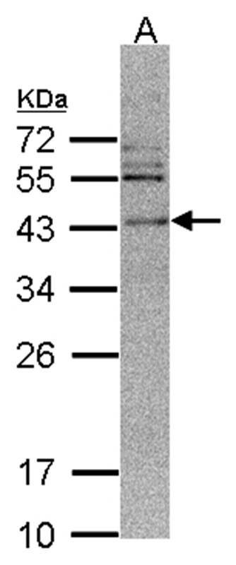 Anti-CAMK1D Antibody