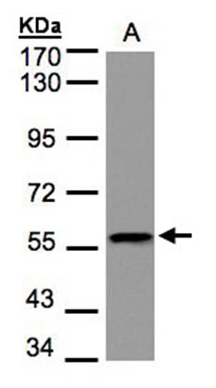 Anti-DUSP8 Antibody