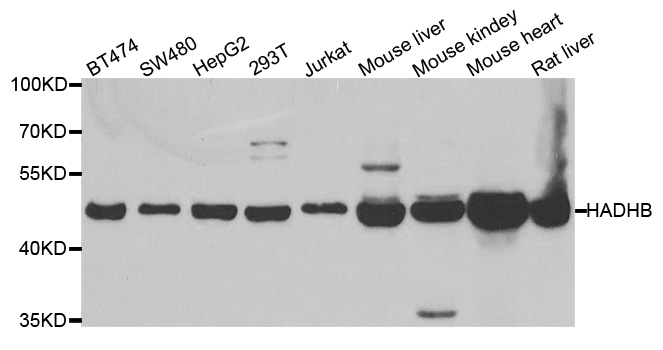 Anti-HADHB Antibody