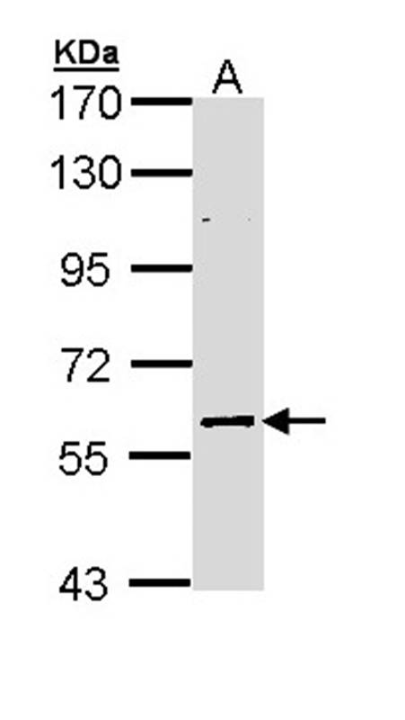 Anti-ELP3 Antibody