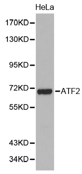 Anti-ATF2 Antibody