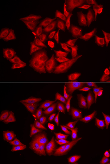 Anti-TLK2 Antibody