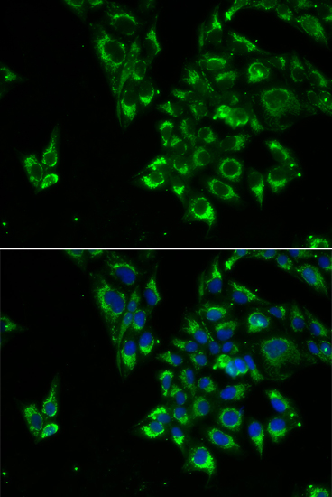 Anti-TSHB Antibody