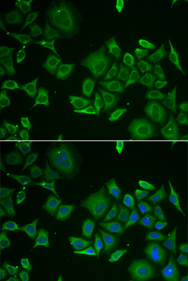 Anti-C1D Antibody