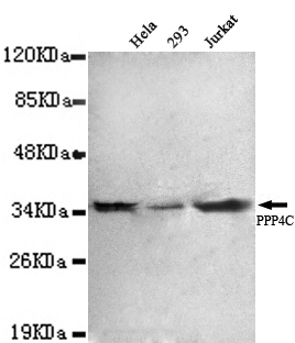 Anti-Protein Phosphatase 4C Antibody