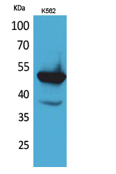 Anti-Protein C Antibody