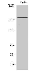 Anti-ABCA8 Antibody