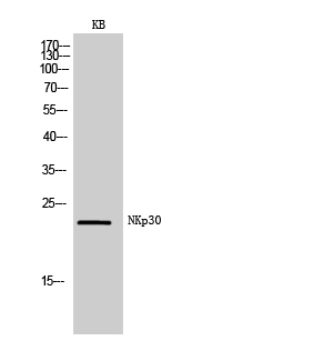 Anti-NKp30 Antibody