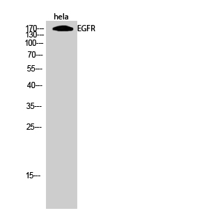 Anti-EGFR Antibody