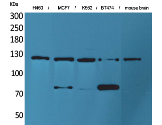 Anti-CD56 Antibody