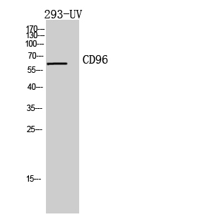 Anti-CD96 Antibody