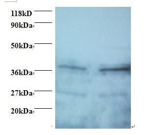 Anti-Secretory carrier-associated membrane protein 3 Antibody