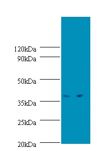 Anti-Transcription initiation protein SPT3 homolog Antibody