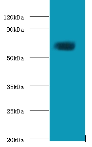 Anti-Protein-glutamine gamma-glutamyltransferase 2 Antibody