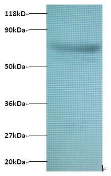 Anti-Actin-related protein 2 / 3 complex subunit 3 Antibody