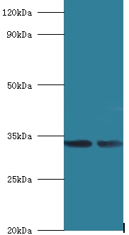 Anti-39S ribosomal protein L19, mitochondrial Antibody