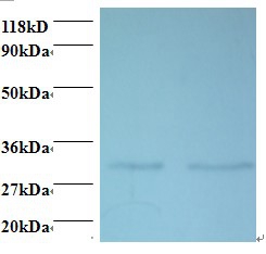 Anti-39S ribosomal protein L9, mitochondrial Antibody