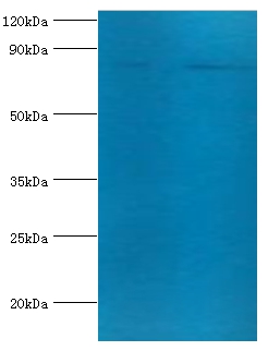 Anti-Transferrin receptor protein 1 Antibody