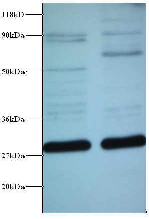 Anti-ES1 protein homolog, mitochondrial Antibody