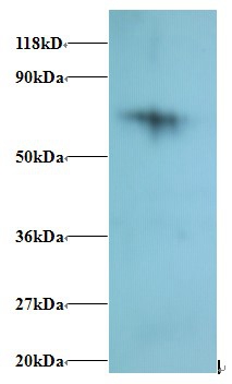 Anti-40S ribosomal protein S18 Antibody