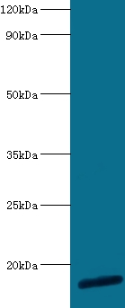 Anti-60S ribosomal protein L30 Antibody