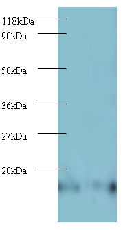 Anti-60S ribosomal protein L27 Antibody