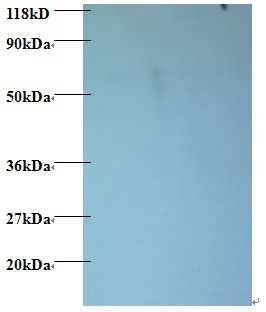 Anti-60S ribosomal protein L15 Antibody