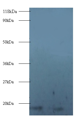 Anti-40S ribosomal protein S16 Antibody