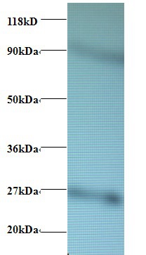 Anti-60S ribosomal protein L17 Antibody