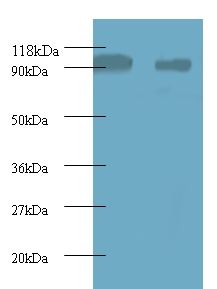 Anti-40S ribosomal protein S12 Antibody