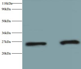 Anti-Retinol-binding protein 4 Antibody