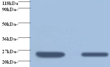 Anti-Retinol-binding protein 4 Antibody