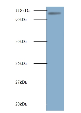 Anti-E3 ubiquitin-protein ligase MIB1 Antibody