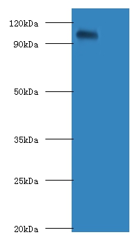 Anti-Amyloid beta A4 protein APolyclonal Antibody