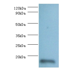 Anti-60S ribosomal protein L36a-like Antibody