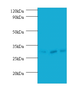 Anti-Checkpoint protein HUS1 Antibody