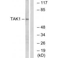 Anti-TAK1 (Ab-184) Antibody