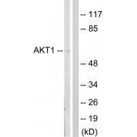 Anti-Akt (Ab-124) Antibody