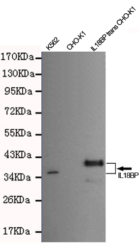 Anti-IL18 binding protein Antibody