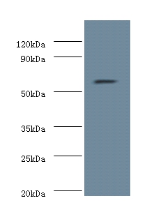 Anti-Nucleolar protein 58 Antibody