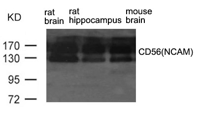 Anti-CD56 (NCAM) Antibody