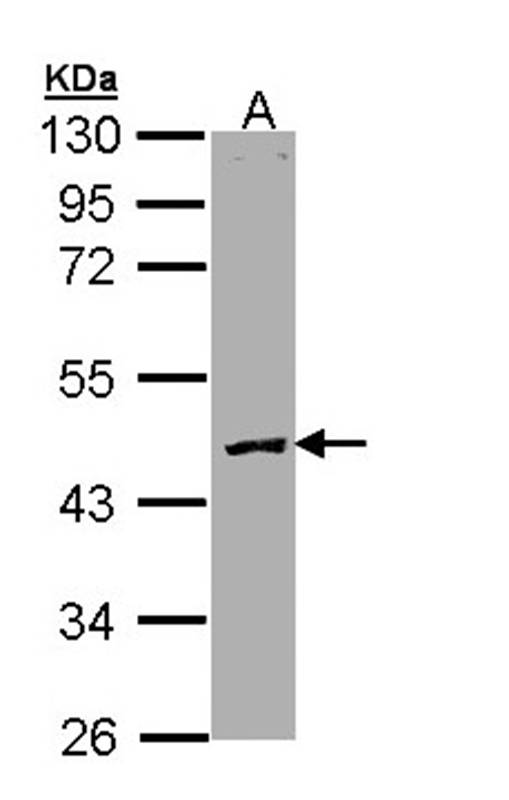 Anti-Protein C Antibody