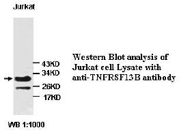 Anti-TNF RSF13B Antibody