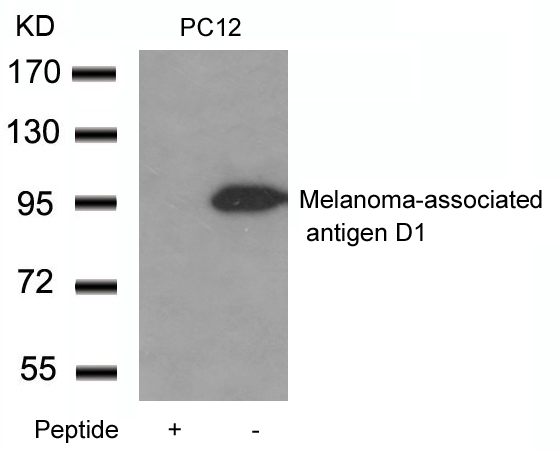 Anti-Melanoma-associated antigen D1 Antibody