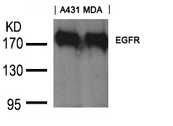 Anti-EGFR (Ab-1197) Goat Antibody