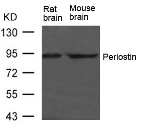 Anti-Periostin Antibody