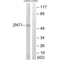 Anti-SLC30A1 Antibody