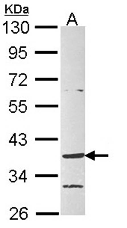 Anti-G protein-coupled receptor 4 Antibody