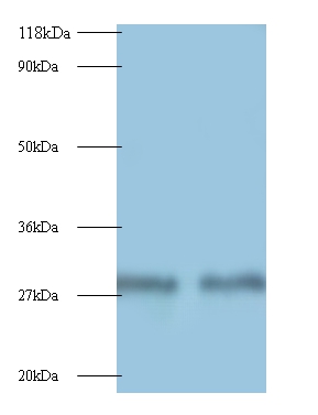 Anti-Myelin protein P0 Antibody